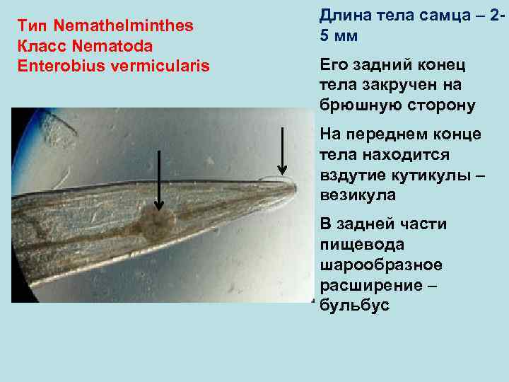  Длина тела самца – 2 - Тип Nemathelminthes 5 мм Класс Nematoda Enterobius