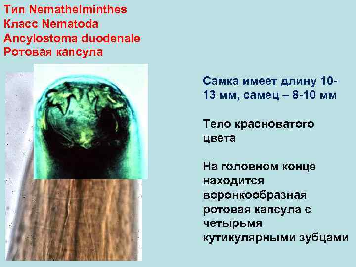 Тип Nemathelminthes Класс Nematoda Ancylostoma duodenale Ротовая капсула Самка имеет длину 10 - 13