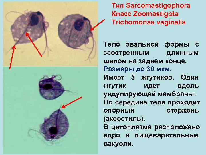  Тип Sarcomastigophora Класс Zoomastigota Trichomonas vaginalis Тело овальной формы с заостренным длинным шипом