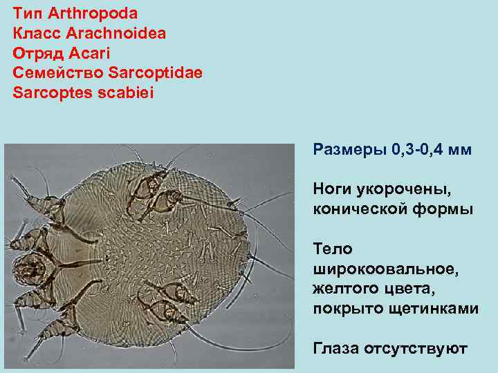 Тип Arthropoda Класс Arachnoidea Отряд Аcari Семейство Sarcoptidae Sarcoptes scabiei Размеры 0, 3 -0,