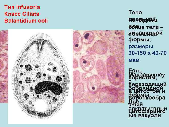 Тип Infusoria Класс Ciliata Тело Balantidium coli овальной На заднем или тела – конце