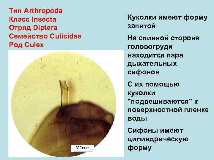 Тип Arthropoda Класс Insecta Куколки имеют форму Отряд Diptera запятой Семейство Culicidae На спинной