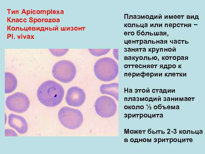 Тип Аpicomplexa Класс Sporozoa Плазмодий имеет вид Кольцевидный шизонт кольца или перстня − Pl.