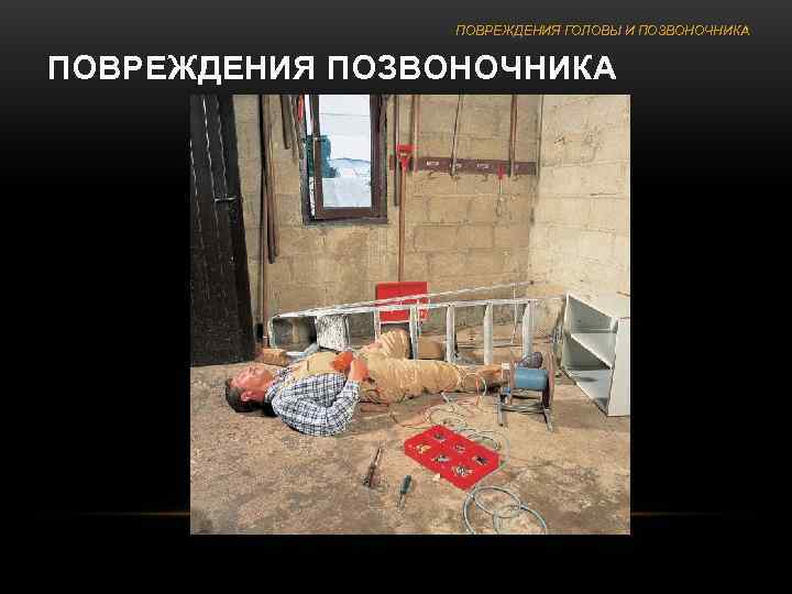    ПОВРЕЖДЕНИЯ ГОЛОВЫ И ПОЗВОНОЧНИКА  ПОВРЕЖДЕНИЯ ПОЗВОНОЧНИКА 