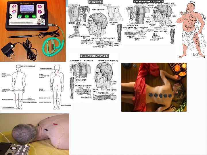  Акупунктурное и электрокупунктурное   обезболивание Преимуществами этого метода перед традиционными фармакологическими: