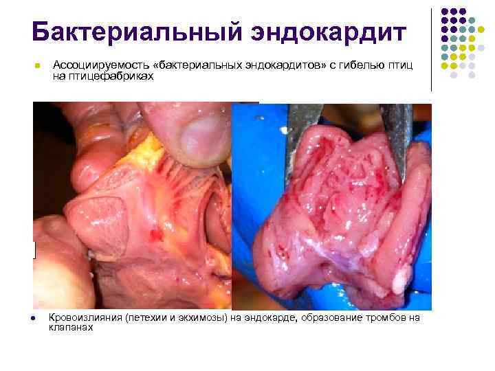 Бактериальный эндокардит n Ассоциируемость «бактериальных эндокардитов» с гибелью птиц на птицефабриках l Кровоизлияния (петехии