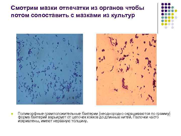 Смотрим мазки отпечатки из органов чтобы потом сопоставить с мазками из культур n Полиморфные