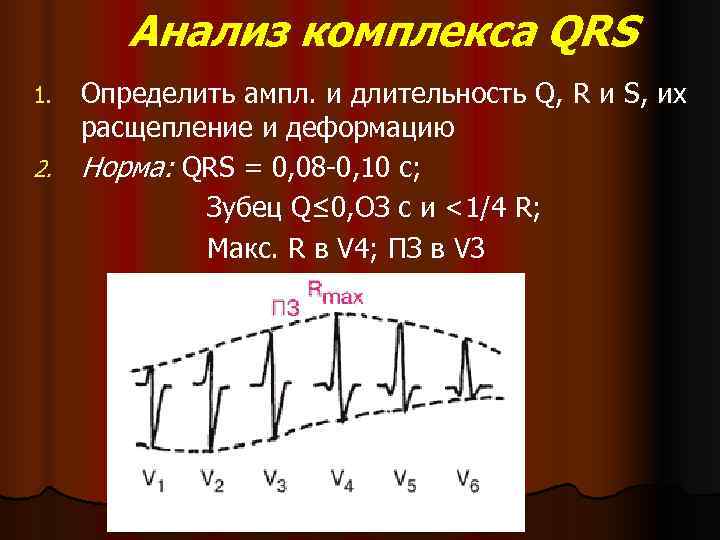 Комплекс qrs