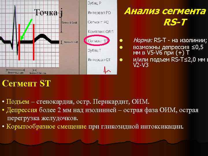    Точка j    Анализ сегмента    