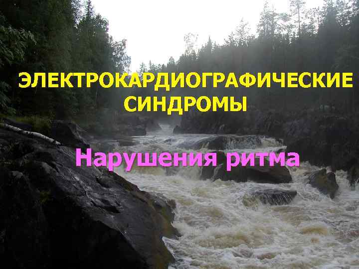 ЭЛЕКТРОКАРДИОГРАФИЧЕСКИЕ   СИНДРОМЫ Нарушения ритма 