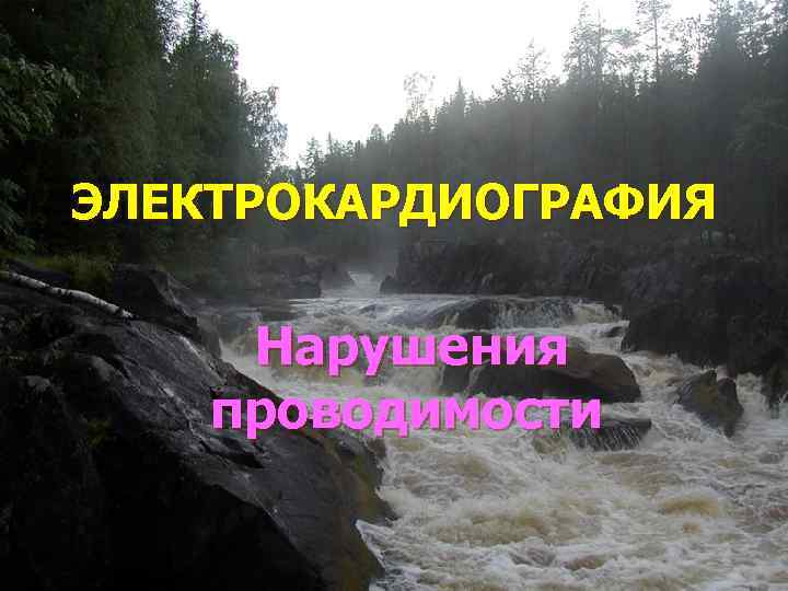 ЭЛЕКТРОКАРДИОГРАФИЯ   Нарушения проводимости 