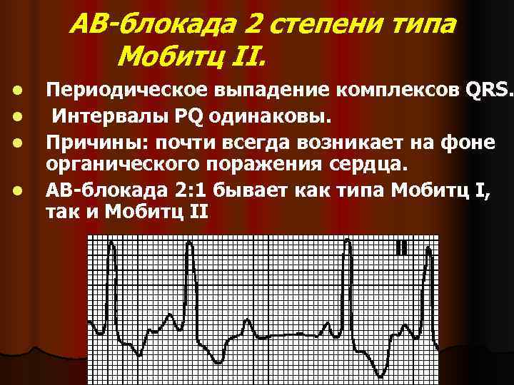 Экг презентация пропедевтика