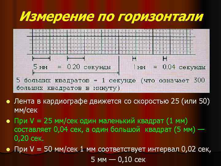 1 секунда в квадрате. При скорости записи ЭКГ 25 мм/сек 1 мм равен. При скорости записи ЭКГ 50 мм/сек 1 мм равен. При скорости 25 мм/сек один миллиметр на кардиограмме. ЭКГ лента 50 мм/сек 0,02.