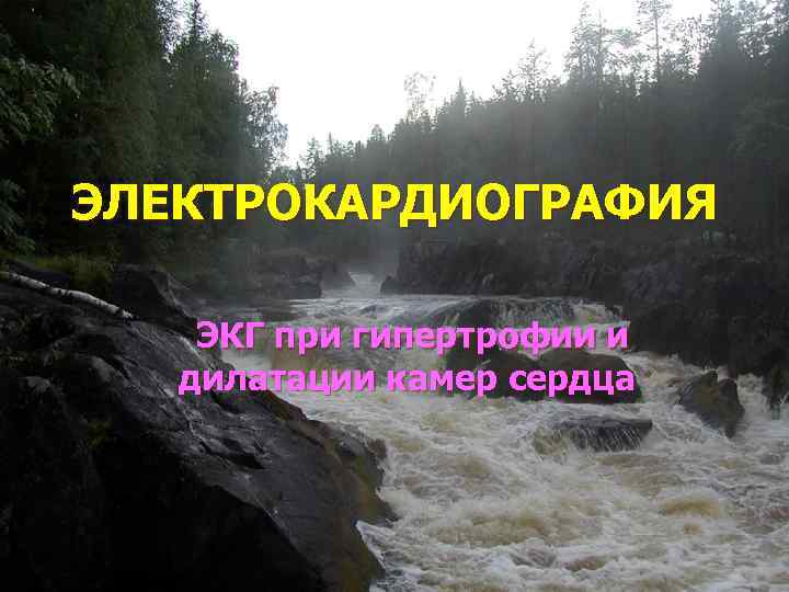 ЭЛЕКТРОКАРДИОГРАФИЯ ЭКГ при гипертрофии и дилатации камер сердца 