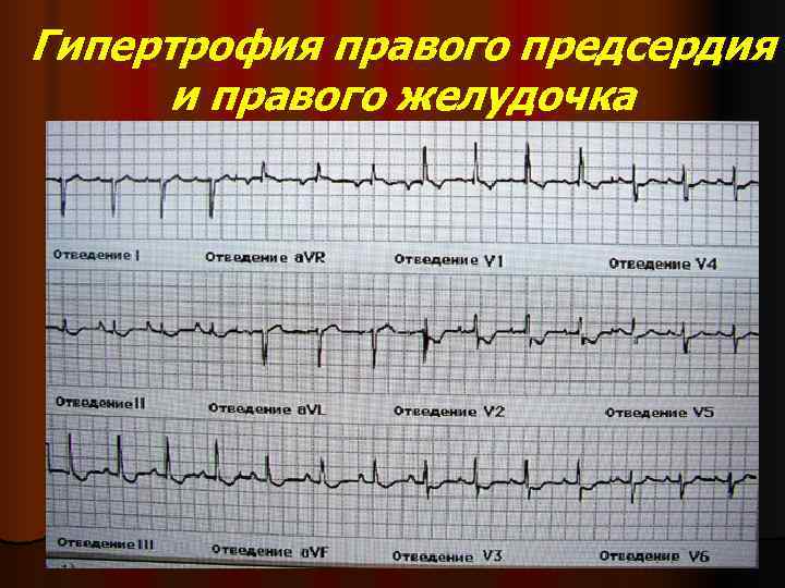 Индекс макруза