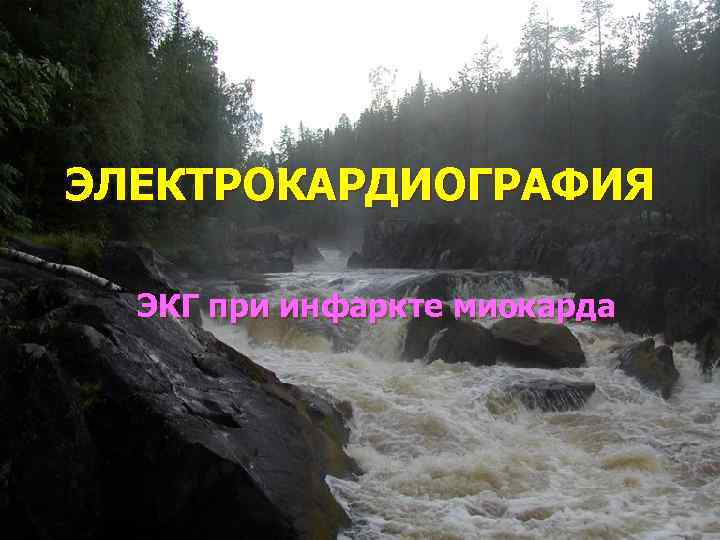 ЭЛЕКТРОКАРДИОГРАФИЯ ЭКГ при инфаркте миокарда 