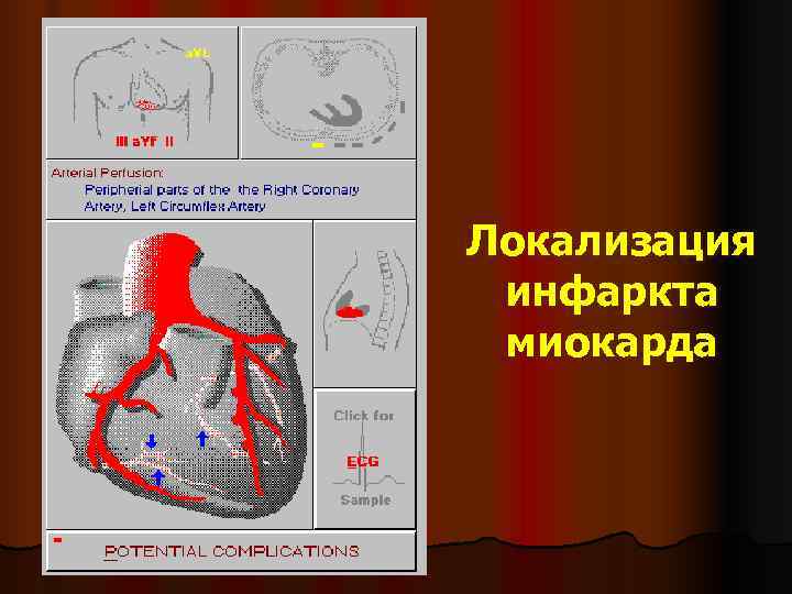 Сосуды сердца схема коронарография