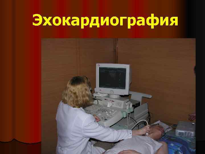 Эхокардиография 