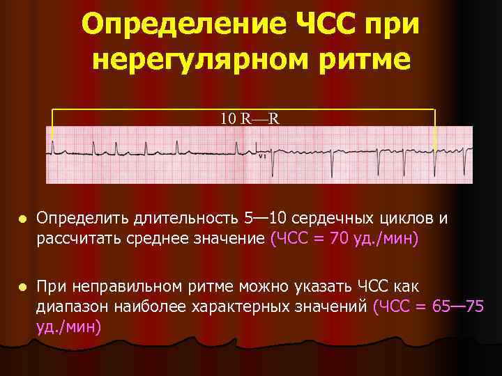 Нерегулярность ритма сердца процентах