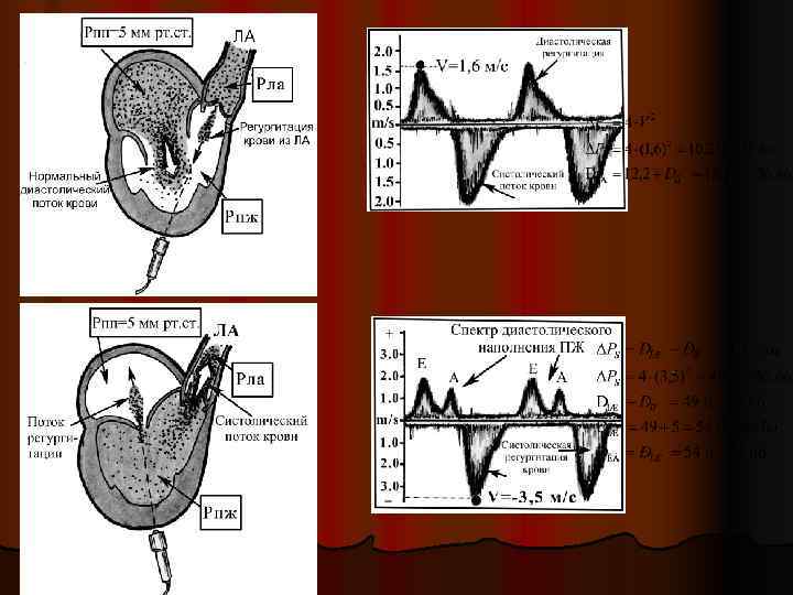 Успеха в освоении ЭКГ ! 