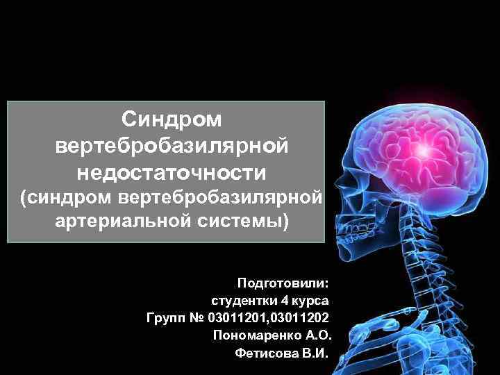  Синдром вертебробазилярной недостаточности (синдром вертебробазилярной артериальной системы) Подготовили: студентки 4 курса Групп №