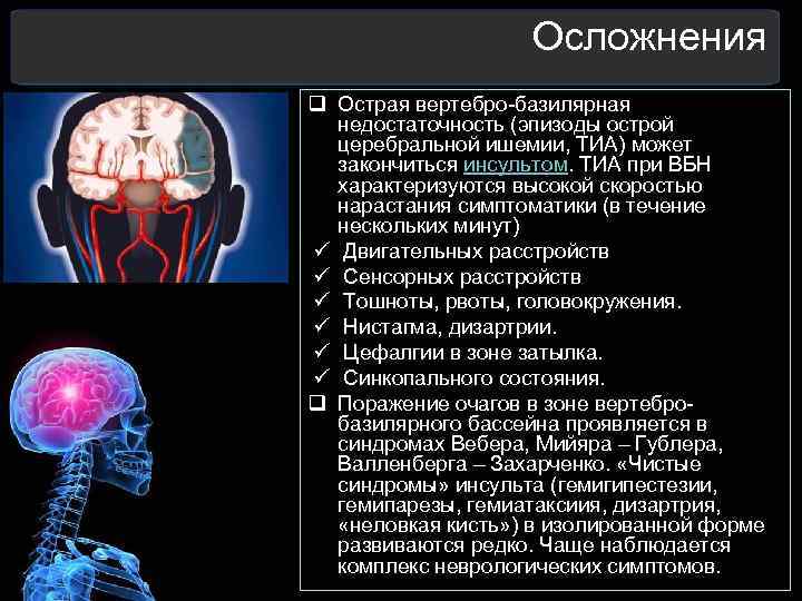  Осложнения q Острая вертебро-базилярная недостаточность (эпизоды острой церебральной ишемии, ТИА) может закончиться инсультом.