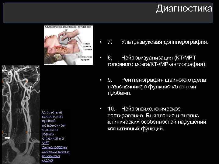  Диагностика • 7. Ультразвуковая допплерография. • 8. Нейровизуализация (КТ/МРТ головного мозга/КТ-/МР-ангиография). • 9.