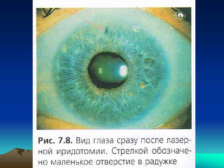     Консервант - ПУРИТ®  • Стабилизированный оксихлоро  комплекс –