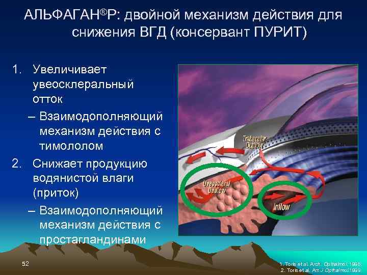      ГЛАУКОМА –   НЕ  ПРИГОВОР !!! 