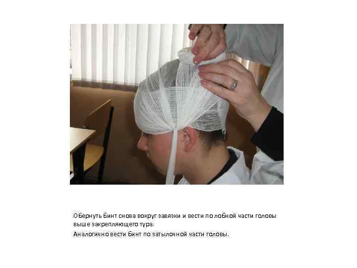 Обернуть бинт снова вокруг завязки и вести по лобной части головы выше закрепляющего тура.