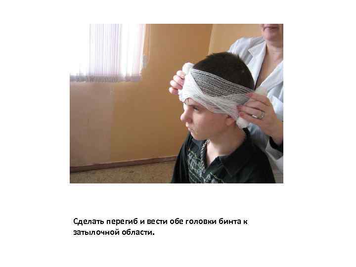 Сделать перегиб и вести обе головки бинта к затылочной области. 