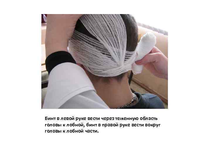 Бинт в левой руке вести через теменную область головы к лобной, бинт в правой