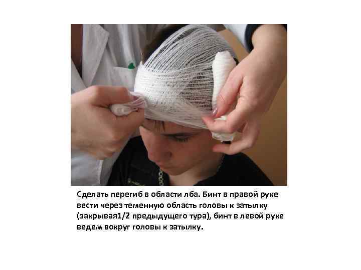 Сделать перегиб в области лба. Бинт в правой руке вести через теменную область головы