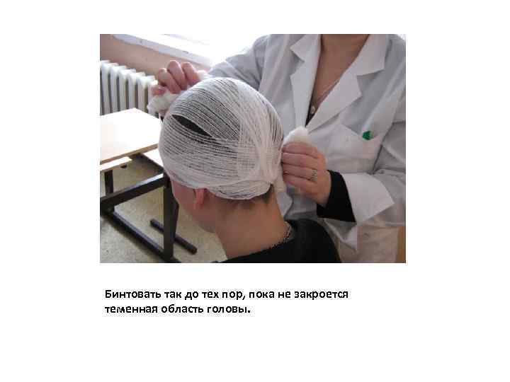 Бинтовать так до тех пор, пока не закроется теменная область головы. 