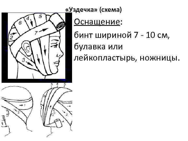  «Уздечка» (схема)  Оснащение:  бинт шириной 7 - 10 см, булавка или