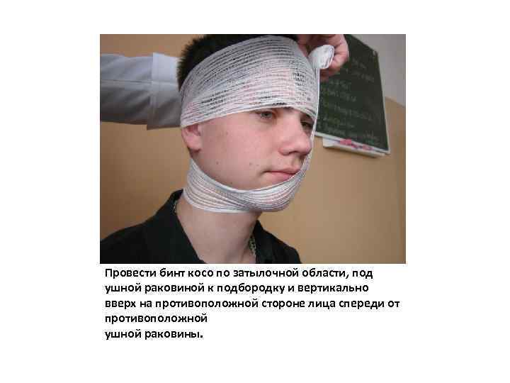 Провести бинт косо по затылочной области, под ушной раковиной к подбородку и вертикально вверх