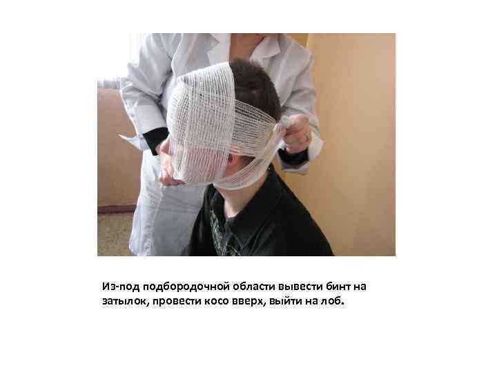 Из-под подбородочной области вывести бинт на затылок, провести косо вверх, выйти на лоб. 