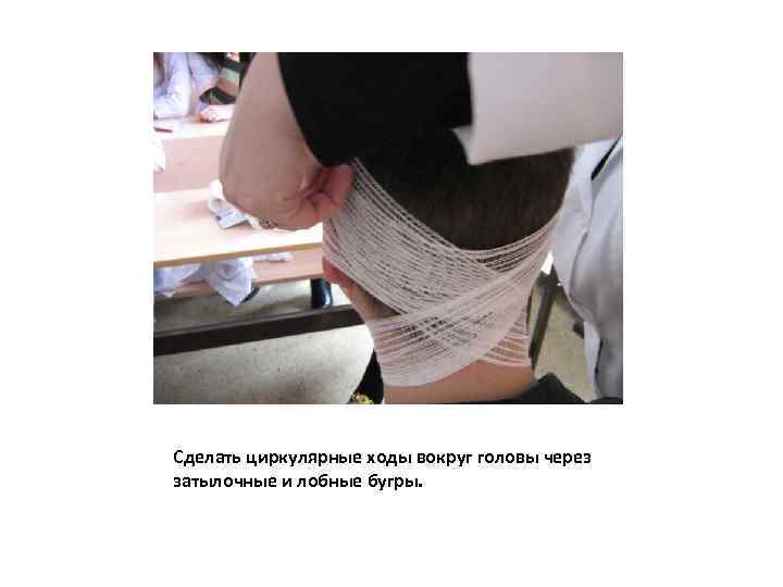 Сделать циркулярные ходы вокруг головы через затылочные и лобные бугры. 