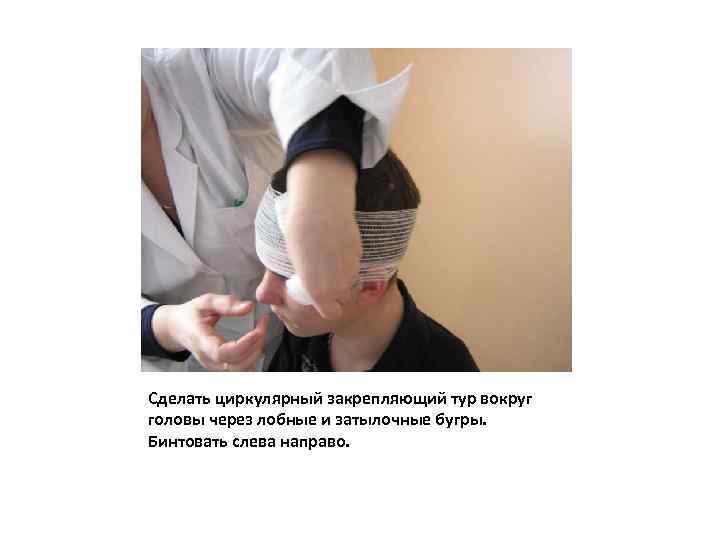 Сделать циркулярный закрепляющий тур вокруг головы через лобные и затылочные бугры. Бинтовать слева направо.