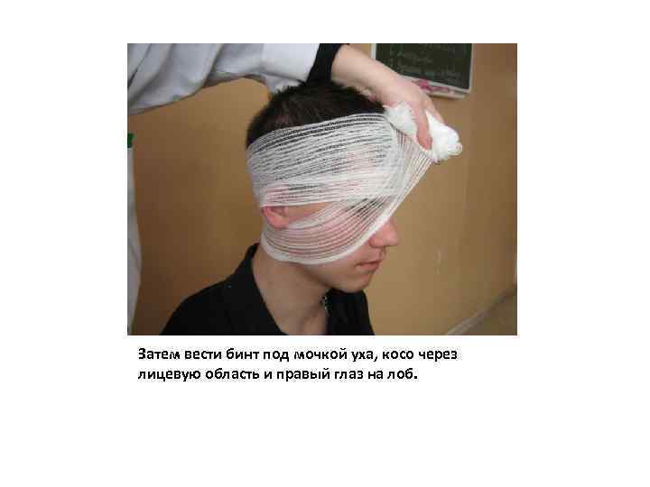 Затем вести бинт под мочкой уха, косо через лицевую область и правый глаз на