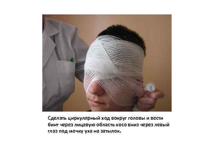 Сделать циркулярный ход вокруг головы и вести бинт через лицевую область косо вниз через