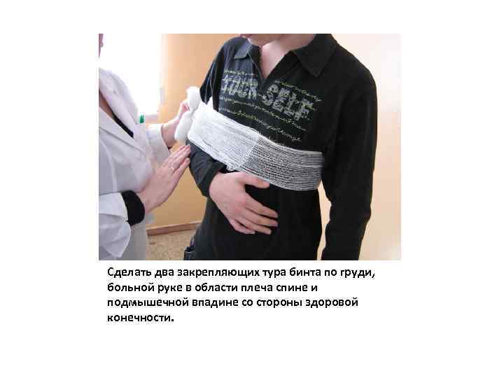 Сделать два закрепляющих тура бинта по груди, больной руке в области плеча спине и