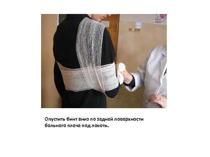 Опустить бинт вниз по задней поверхности больного плеча под локоть. 