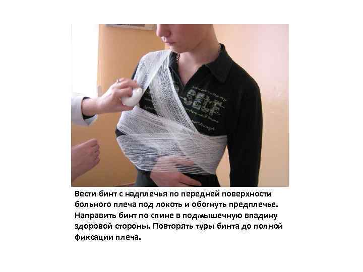 Вести бинт с надплечья по передней поверхности больного плеча под локоть и обогнуть предплечье.