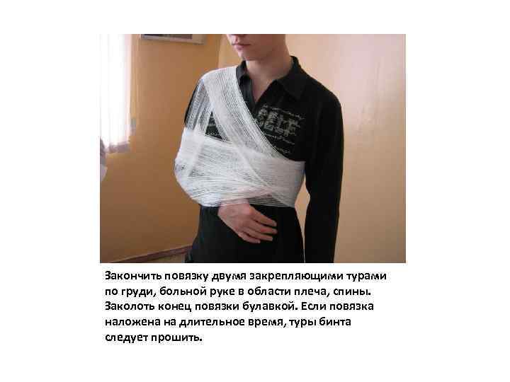Закончить повязку двумя закрепляющими турами по груди, больной руке в области плеча, спины. Заколоть