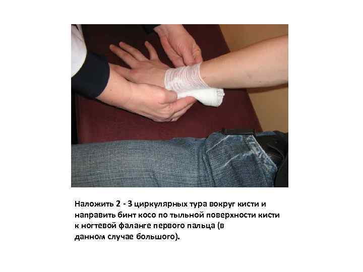Наложить 2 - 3 циркулярных тура вокруг кисти и направить бинт косо по тыльной