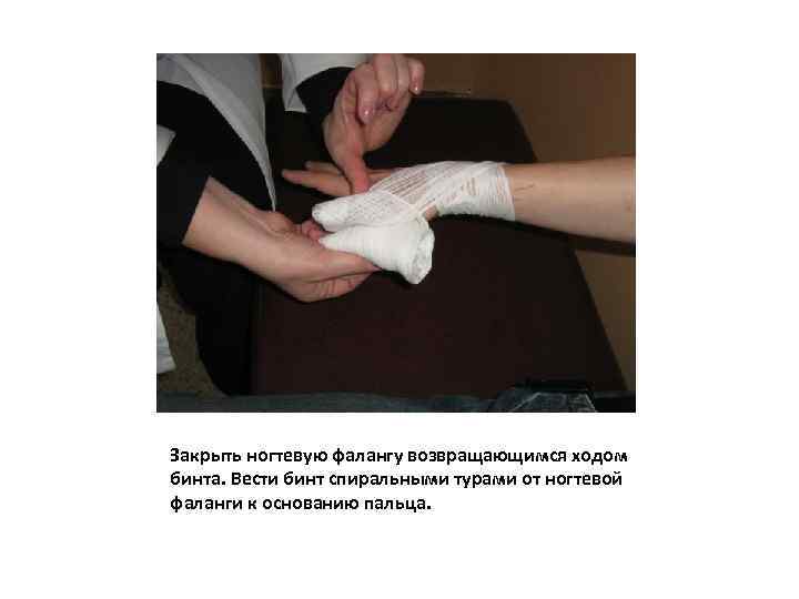Закрыть ногтевую фалангу возвращающимся ходом бинта. Вести бинт спиральными турами от ногтевой фаланги к