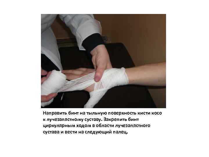 Направить бинт на тыльную поверхность кисти косо к лучезапястному суставу. Закрепить бинт циркулярным ходом