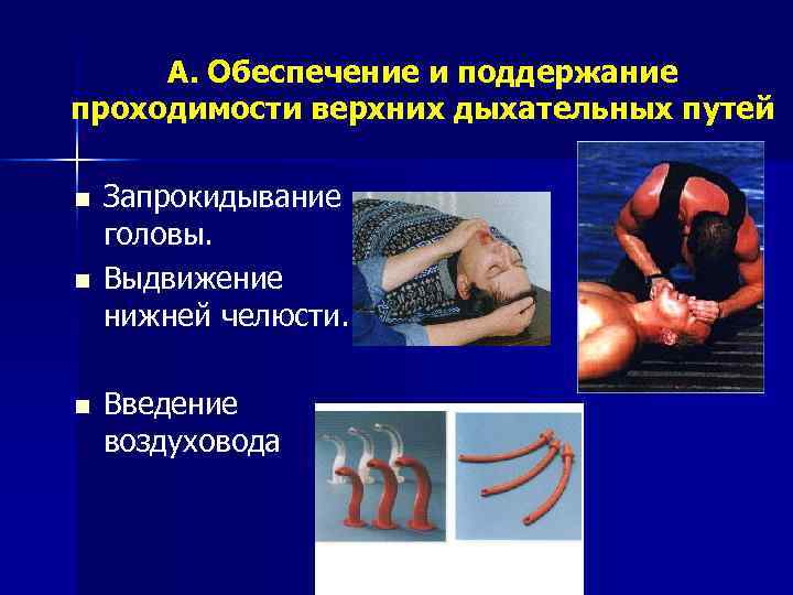  A. Обеспечение и поддержание проходимости верхних дыхательных путей n  Запрокидывание головы. n