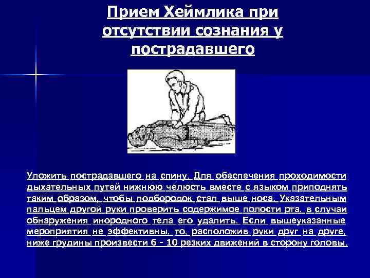     Прием Хеймлика при    отсутствии сознания у 